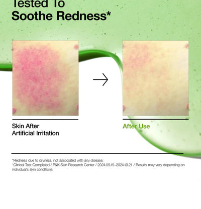 Anua Azelaic Acid 10% + Hyaluron Serum (30ml)