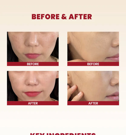 SEOUL 1988 Cream : Snail Mucin 93% + Rice