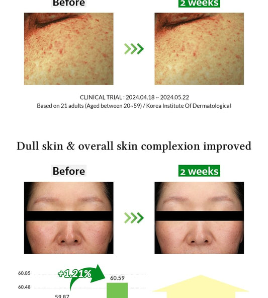 Dr. Althea Gentle Vitamin C Serum