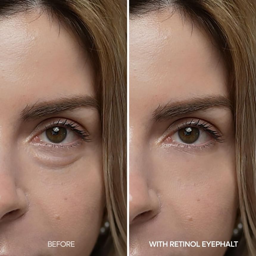 Dr.Melaxin Eyephalt Retinol Eyebag Cream