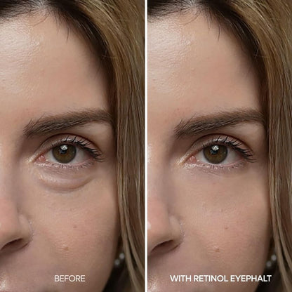Dr.Melaxin Eyephalt Retinol Eyebag Cream