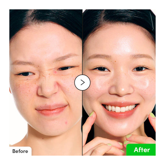 EQQUAL BERRY Aloe PDRN Calming Serum