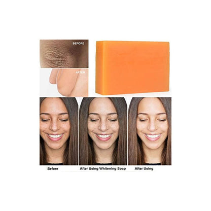 Kojie San Skin Lightening Soap – Classic (135g)